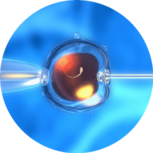 Fertilización-In-Vitro Fertilización-In-Vitro